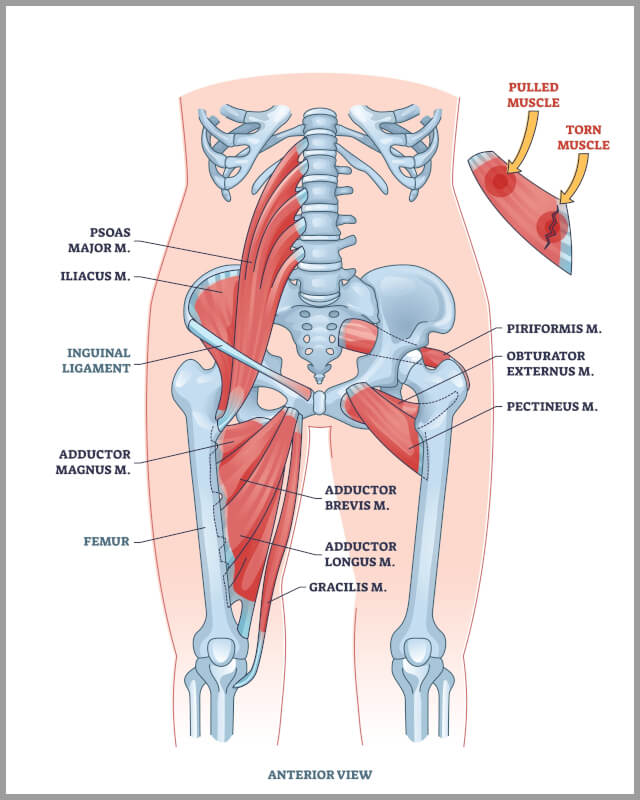 Groin Pain